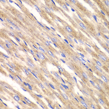 SLC25A4 / ANT Antibody - Immunohistochemistry of paraffin-embedded rat heart.