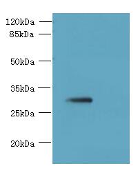 SLC25A4 / ANT Antibody - Western blot. All lanes: SLC25A4 antibody at 8 ug/ml+ Mouse brain tissue Goat polyclonal to rabbit at 1:10000 dilution. Predicted band size: 33 kDa. Observed band size: 33 kDa.