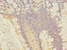 SLC25A4 / ANT Antibody - Immunohistochemistry of paraffin-embedded human small intestine tissue using antibody at dilution of 1:100.