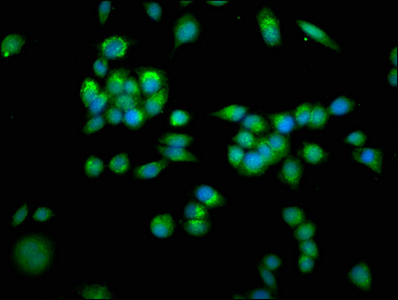 SLC25A4 / ANT Antibody - Immunofluorescence staining of PC-3 cells with SLC25A4 Antibody at 1:266, counter-stained with DAPI. The cells were fixed in 4% formaldehyde, permeabilized using 0.2% Triton X-100 and blocked in 10% normal Goat Serum. The cells were then incubated with the antibody overnight at 4°C. The secondary antibody was Alexa Fluor 488-congugated AffiniPure Goat Anti-Rabbit IgG(H+L).