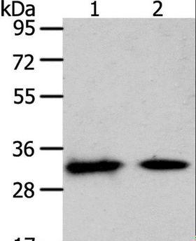 SLC25A4 / ANT Antibody - Western blot analysis of Mouse heart and muscle tissue, using SLC25A4 Polyclonal Antibody at dilution of 1:400.