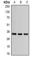 SLC25A4 / ANT Antibody - Western blot analysis of ANT1 expression in SW620 (A); HepG2 (B); mouse brain (C) whole cell lysates.