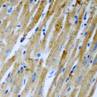 SLC25A4 / ANT Antibody - Immunohistochemical analysis of ANT1 staining in rat heart formalin fixed paraffin embedded tissue section. The section was pre-treated using heat mediated antigen retrieval with sodium citrate buffer (pH 6.0). The section was then incubated with the antibody at room temperature and detected using an HRP conjugated compact polymer system. DAB was used as the chromogen. The section was then counterstained with hematoxylin and mounted with DPX.