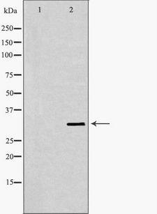 SLC25A4 / ANT Antibody - Western blot analysis of HepG2 cell lysates using SLC25A4 antibody. The lane on the left is treated with the antigen-specific peptide.
