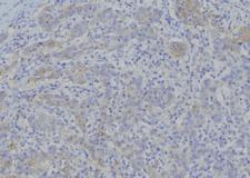 SLC25A4 / ANT Antibody - 1:100 staining human gastric tissue by IHC-P. The sample was formaldehyde fixed and a heat mediated antigen retrieval step in citrate buffer was performed. The sample was then blocked and incubated with the antibody for 1.5 hours at 22°C. An HRP conjugated goat anti-rabbit antibody was used as the secondary.