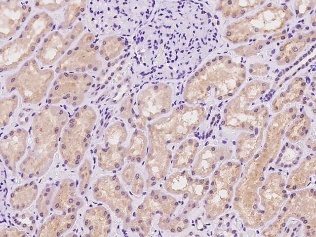 SLC25A41 Antibody - Immunochemical staining of human SLC25A41 in human kidney with rabbit polyclonal antibody at 1:100 dilution, formalin-fixed paraffin embedded sections.