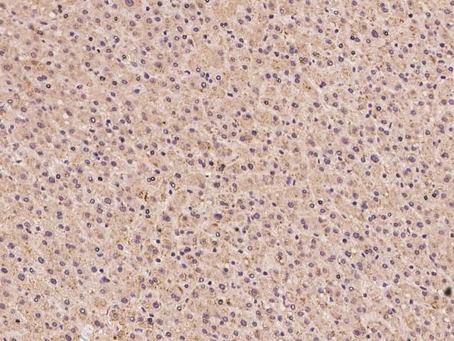 SLC25A41 Antibody - Immunochemical staining of human SLC25A41 in human liver with rabbit polyclonal antibody at 1:100 dilution, formalin-fixed paraffin embedded sections.