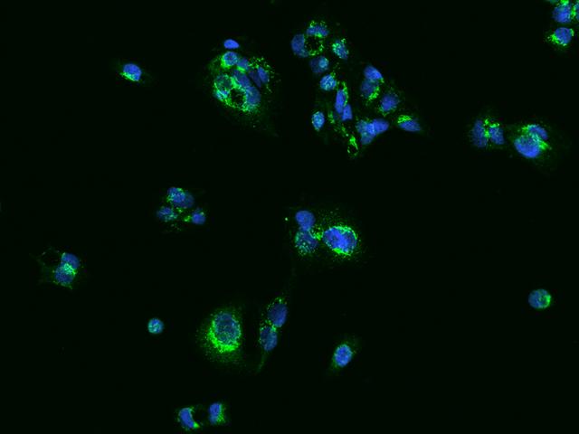 SLC25A42 Antibody - Immunofluorescence staining of SLC25A42 in HepG2 cells. Cells were fixed with 4% PFA, permeabilzed with 0.1% Triton X-100 in PBS, blocked with 10% serum, and incubated with rabbit anti-Human SLC25A42 polyclonal antibody (dilution ratio 1:200) at 4°C overnight. Then cells were stained with the Alexa Fluor 488-conjugated Goat Anti-rabbit IgG secondary antibody (green) and counterstained with DAPI (blue). Positive staining was localized to Cytoplasm.
