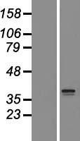 SLC25A44 Protein - Western validation with an anti-DDK antibody * L: Control HEK293 lysate R: Over-expression lysate