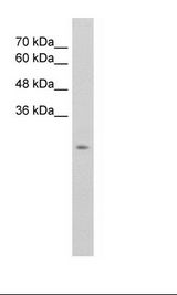 SLC25A45 Antibody - HepG2 Cell Lysate.  This image was taken for the unconjugated form of this product. Other forms have not been tested.