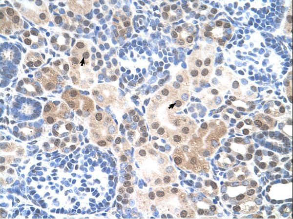 SLC25A45 Antibody - SLC25A45 antibody ARP43809_T100-NP_001070709-LOC283130 Antibody was used in IHC to stain formalin-fixed, paraffin-embedded human kidney.  This image was taken for the unconjugated form of this product. Other forms have not been tested.