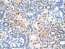 SLC25A45 Antibody - SLC25A45 antibody ARP43809_T100-NP_001070709-LOC283130 Antibody was used in IHC to stain formalin-fixed, paraffin-embedded human kidney.  This image was taken for the unconjugated form of this product. Other forms have not been tested.