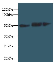 SLC25A46 Antibody - Western blot. All lanes: SLC25A46 antibody at 6 ug/ml. Lane 1: Mouse brain tissue. Lane 2: HeLa whole cell lysate. Lane 3: Jurkat whole cell lysate. Secondary antibody: Goat polyclonal to Rabbit IgG at 1:10000 dilution. Predicted band size: 46 kDa. Observed band size: 46 kDa.