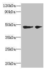 SLC25A46 Antibody - Western blot All lanes: SLC25A46 antibody at 6µg/ml Lane 1: Mouse brain tissue Lane 2: Jurkat whole cell lysate Secondary Goat polyclonal to rabbit IgG at 1/10000 dilution Predicted band size: 47, 31, 38 kDa Observed band size: 47 kDa
