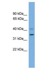 SLC25A48 Antibody - SLC25A48 antibody Western Blot of Human Muscle.  This image was taken for the unconjugated form of this product. Other forms have not been tested.