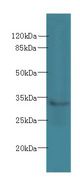 SLC25A51 / MCART1 Antibody - Western blot. All lanes: SLC25A51 antibody at 8 ug/ml+ Mouse kidney tissue Goat polyclonal to rabbit at 1:10000 dilution. Predicted band size: 34 kDa. Observed band size: 34 kDa.