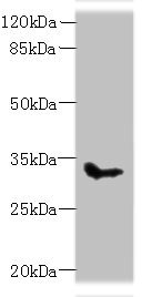 SLC25A51 / MCART1 Antibody - Western blot All lanes: SLC25A51 antibody at 8µg/ml + Mouse kidney tissue Secondary Goat polyclonal to rabbit IgG at 1/10000 dilution Predicted band size: 34 kDa Observed band size: 34 kDa