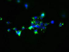 SLC25A51 / MCART1 Antibody - Immunofluorescent analysis of 293 cells using SLC25A51 Antibody at dilution of 1:100 and Alexa Fluor 488-congugated AffiniPure Goat Anti-Rabbit IgG(H+L)