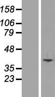 SLC25A51 / MCART1 Protein - Western validation with an anti-DDK antibody * L: Control HEK293 lysate R: Over-expression lysate