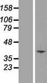 SLC25A51 / MCART1 Protein - Western validation with an anti-DDK antibody * L: Control HEK293 lysate R: Over-expression lysate