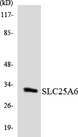 SLC25A6 / ANT3 Antibody - Western blot analysis of the lysates from K562 cells using SLC25A6 antibody.