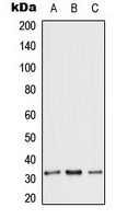 SLC25A6 / ANT3 Antibody - Western blot analysis of ANT3 expression in HeLa (A); Raw264.7 (B); rat heart (C) whole cell lysates.