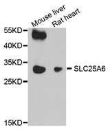 SLC25A6 / ANT3 Antibody - Western blot analysis of extract of various cells.