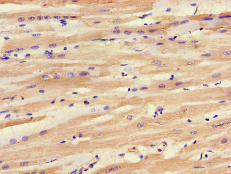 SLC25A6 / ANT3 Antibody - Immunohistochemistry of paraffin-embedded human heart tissue using SLC25A6 Antibody at dilution of 1:100