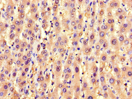 SLC25A6 / ANT3 Antibody - Immunohistochemistry of paraffin-embedded human liver tissue using SLC25A6 Antibody at dilution of 1:100