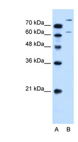 SLC26A1 Antibody - SLC26A1 antibody ARP44028_P050-NP_071325-SLC26A1(solute carrier family 26 (sulfate transporter), member 1) Antibody Western blot of HepG2 cell lysate.  This image was taken for the unconjugated form of this product. Other forms have not been tested.