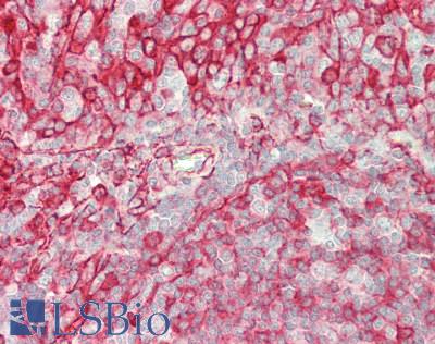 SLC26A1 Antibody - Human Tonsil: Formalin-Fixed, Paraffin-Embedded (FFPE)
