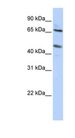 SLC26A10 Antibody - SLC26A10 antibody Western blot of HepG2 cell lysate. This image was taken for the unconjugated form of this product. Other forms have not been tested.