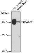 SLC26A11 Antibody - Western blot analysis of extracts of various cell lines using SLC26A11 Polyclonal Antibody at dilution of 1:1000.