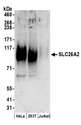 SLC26A2 Antibody - Detection of human SLC26A2 by western blot. Samples: Whole cell lysate (50 µg) from HeLa, HEK293T, and Jurkat cells prepared using RIPA lysis buffer. Antibodies: Affinity purified rabbit anti-SLC26A2 antibody used for WB at 0.1 µg/ml. Detection: Chemiluminescence with an exposure time of 3 minutes.