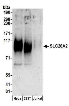 SLC26A2 Antibody - Detection of human SLC26A2 by western blot. Samples: Whole cell lysate (50 µg) from HeLa, HEK293T, and Jurkat cells prepared using RIPA lysis buffer. Antibodies: Affinity purified rabbit anti-SLC26A2 antibody used for WB at 0.1 µg/ml. Detection: Chemiluminescence with an exposure time of 3 minutes.