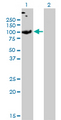 SLC26A2 Antibody - Western Blot analysis of SLC26A2 expression in transfected 293T cell line by SLC26A2 monoclonal antibody (M04), clone 3F6.Lane 1: SLC26A2 transfected lysate(81.6 KDa).Lane 2: Non-transfected lysate.