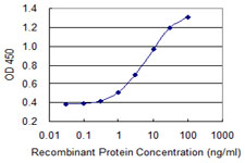 SLC26A2 Antibody - Detection limit for recombinant GST tagged SLC26A2 is 0.1 ng/ml as a capture antibody.