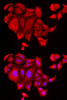 SLC26A2 Antibody - Immunofluorescence analysis of HeLa cells.