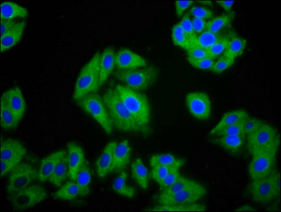 SLC26A2 Antibody - Immunofluorescence staining of HepG2 cells diluted at 1:100, counter-stained with DAPI. The cells were fixed in 4% formaldehyde, permeabilized using 0.2% Triton X-100 and blocked in 10% normal Goat Serum. The cells were then incubated with the antibody overnight at 4°C.The Secondary antibody was Alexa Fluor 488-congugated AffiniPure Goat Anti-Rabbit IgG (H+L).