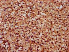 SLC26A2 Antibody - Immunohistochemistry Dilution at 1:300 and staining in paraffin-embedded human adrenal gland tissue performed on a Leica BondTM system. After dewaxing and hydration, antigen retrieval was mediated by high pressure in a citrate buffer (pH 6.0). Section was blocked with 10% normal Goat serum 30min at RT. Then primary antibody (1% BSA) was incubated at 4°C overnight. The primary is detected by a biotinylated Secondary antibody and visualized using an HRP conjugated SP system.