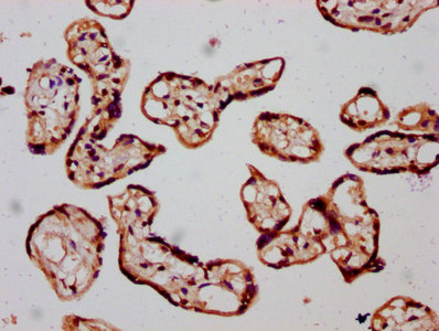 SLC26A2 Antibody - Immunohistochemistry Dilution at 1:300 and staining in paraffin-embedded human placenta tissue performed on a Leica BondTM system. After dewaxing and hydration, antigen retrieval was mediated by high pressure in a citrate buffer (pH 6.0). Section was blocked with 10% normal Goat serum 30min at RT. Then primary antibody (1% BSA) was incubated at 4°C overnight. The primary is detected by a biotinylated Secondary antibody and visualized using an HRP conjugated SP system.