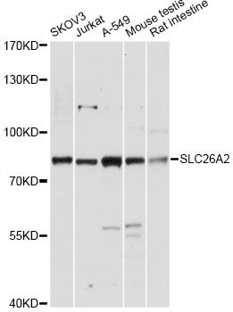 SLC26A2 Antibody - Western blot analysis of extracts of various cell lines, using SLC26A2 antibody at 1:3000 dilution. The secondary antibody used was an HRP Goat Anti-Rabbit IgG (H+L) at 1:10000 dilution. Lysates were loaded 25ug per lane and 3% nonfat dry milk in TBST was used for blocking. An ECL Kit was used for detection and the exposure time was 30s.