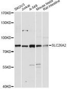 SLC26A2 Antibody - Western blot analysis of extracts of various cell lines, using SLC26A2 antibody at 1:3000 dilution. The secondary antibody used was an HRP Goat Anti-Rabbit IgG (H+L) at 1:10000 dilution. Lysates were loaded 25ug per lane and 3% nonfat dry milk in TBST was used for blocking. An ECL Kit was used for detection and the exposure time was 30s.
