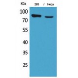 SLC26A3 / DRA Antibody - Western blot of DRA antibody