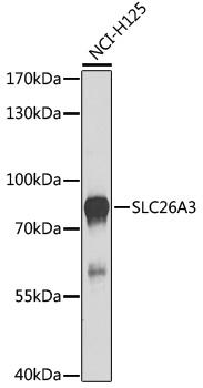 SLC26A3 / DRA Antibody - Western blot analysis of extracts of NCI-H125 cells using SLC26A3 Polyclonal Antibody at dilution of 1:1000.