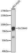 SLC26A3 / DRA Antibody - Western blot analysis of extracts of NCI-H125 cells using SLC26A3 Polyclonal Antibody at dilution of 1:1000.