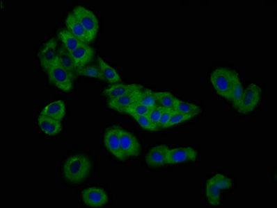 SLC26A4 / Pendrin Antibody - Immunofluorescence staining of HepG2 cells at a dilution of 1:166, counter-stained with DAPI. The cells were fixed in 4% formaldehyde, permeabilized using 0.2% Triton X-100 and blocked in 10% normal Goat Serum. The cells were then incubated with the antibody overnight at 4 °C.The secondary antibody was Alexa Fluor 488-congugated AffiniPure Goat Anti-Rabbit IgG (H+L) .