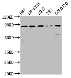 SLC26A4 / Pendrin Antibody - Positive Western Blot detected in U87 whole cell lysate, SH-SY5Y whole cell lysate, 293T whole cell lysate, 293 whole cell lysate, COLO320 whole cell lysate. All lanes: SLC26A4 antibody at 5.7 µg/ml Secondary Goat polyclonal to rabbit IgG at 1/50000 dilution. Predicted band size: 86, 40 KDa. Observed band size: 86 KDa