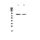 SLC26A4 / Pendrin Antibody - Western blot analysis of SLC26A4 using anti-SLC26A4 antibody. Lane 1: 50 µg human HK-2 whole cell lysates, Lane 2: 50 µg human 293T whole cell lysates. Electrophoresis was performed on a 5-20% SDS-PAGE under reducing conditions. Transferred to a Nitrocellulose membrane. Blocked with 5% Non-fat Milk/ TBS for 1.5 hour at RT.  Incubated with anti-SLC26A4 polyclonal antibody at 0.5 µg/mL overnight at 4°C. Washed with TBS-0.1%Tween 3 times with 5 minutes each.  Incubated with goat anti-rabbit IgG-HRP secondary antibody at a dilution of 1:10000 for 1.5 hour at RT. Signal was developed using an Enhanced Chemiluminescent detection (ECL) kit with Tanon 5200 system. A specific band was detected for SLC26A4 at approximately 86KD. The expected band size for SLC26A4 is at 86KD.