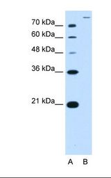 SLC26A5 Antibody - Lane A: Marker. Lane B: HepG2 cell lysate. Antibody concentration: 2.5 ug/ml. Gel concentration: 12%.  This image was taken for the unconjugated form of this product. Other forms have not been tested.